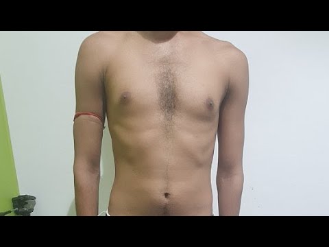 Lump in armpit breast